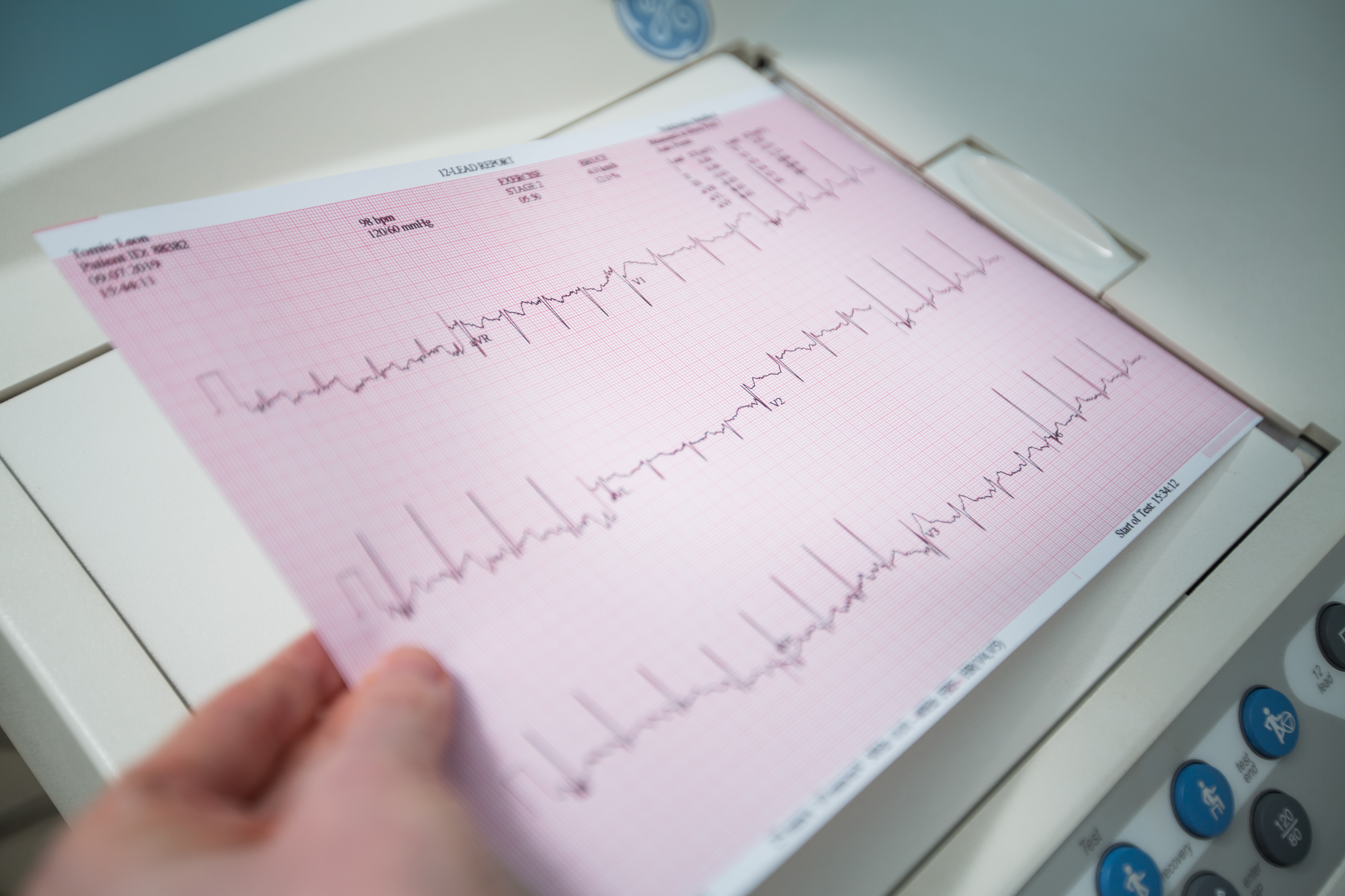 EKG