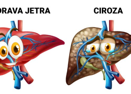 Masna Jetra i Ciroza