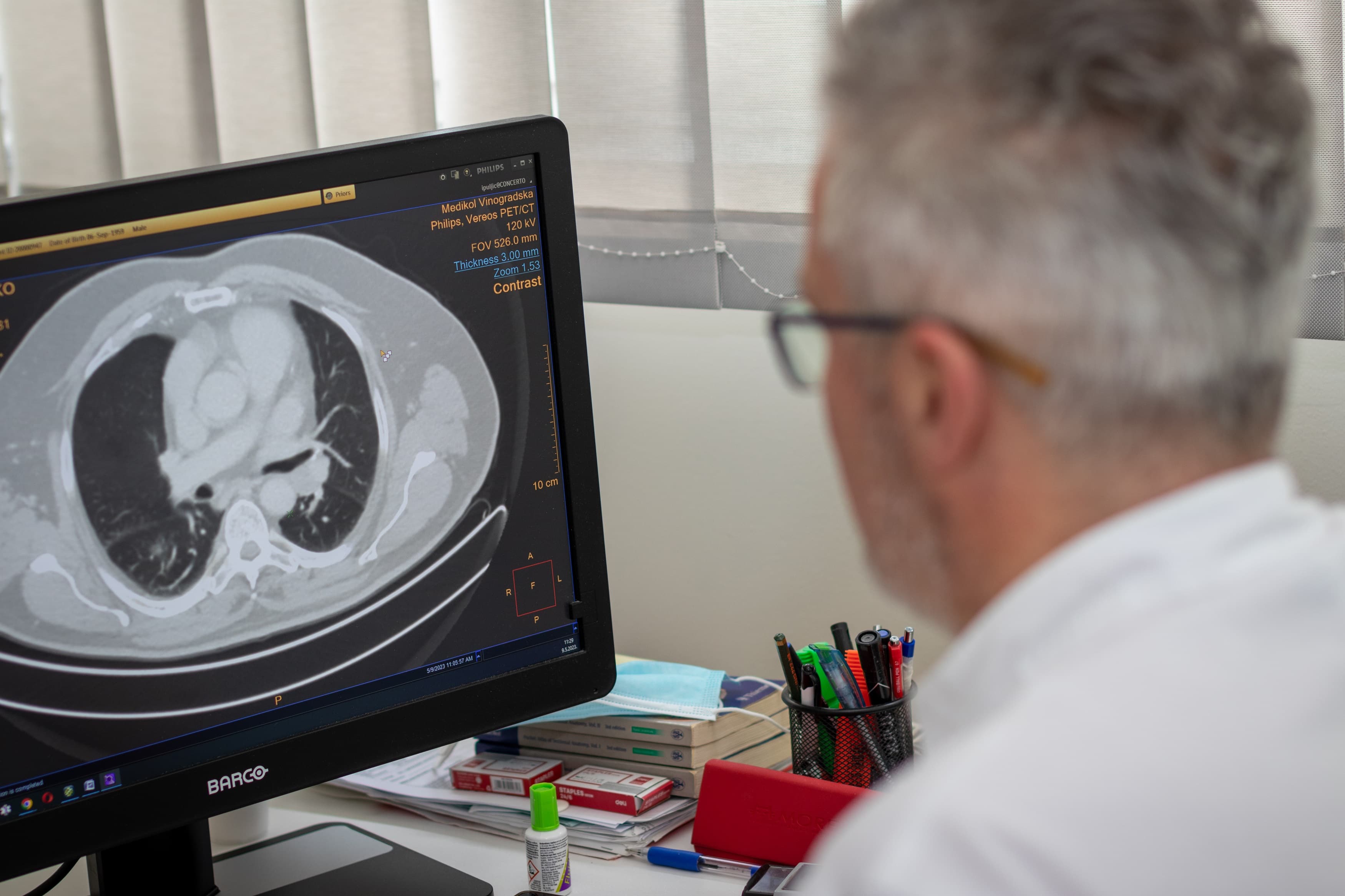 low dose CT pluća Medikol